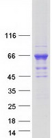 CAMKK2 Protein - Purified recombinant protein CAMKK2 was analyzed by SDS-PAGE gel and Coomassie Blue Staining