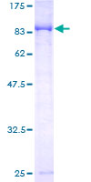 CAMKV Protein - 12.5% SDS-PAGE of human CAMKV stained with Coomassie Blue
