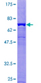 CANT1 Protein - 12.5% SDS-PAGE of human CANT1 stained with Coomassie Blue