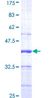 CANT1 Protein - 12.5% SDS-PAGE Stained with Coomassie Blue.