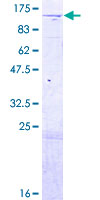 CAP-G2 / MTB Protein - 12.5% SDS-PAGE of human NCAPG2 stained with Coomassie Blue