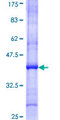 CAP-G2 / MTB Protein - 12.5% SDS-PAGE Stained with Coomassie Blue.