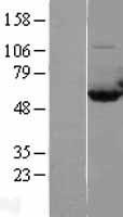 CAP1 Protein - Western validation with an anti-DDK antibody * L: Control HEK293 lysate R: Over-expression lysate