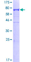 CAP1 Protein - 12.5% SDS-PAGE of human CAP1 stained with Coomassie Blue