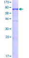CAP1 Protein - 12.5% SDS-PAGE of human CAP1 stained with Coomassie Blue