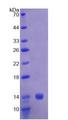 CAP1 Protein - Recombinant Adenylyl Cyclase Associated Protein 1 By SDS-PAGE
