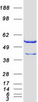 CAP1 Protein - Purified recombinant protein CAP1 was analyzed by SDS-PAGE gel and Coomassie Blue Staining