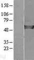 CAP2 Protein - Western validation with an anti-DDK antibody * L: Control HEK293 lysate R: Over-expression lysate