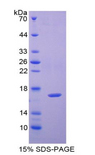 CAP2 Protein - Recombinant Adenylyl Cyclase Associated Protein 2 By SDS-PAGE