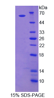 CAP2 Protein - Recombinant Adenylyl Cyclase Associated Protein 2 By SDS-PAGE