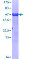 CAPG Protein - 12.5% SDS-PAGE of human CAPG stained with Coomassie Blue