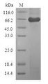 CAPG Protein - (Tris-Glycine gel) Discontinuous SDS-PAGE (reduced) with 5% enrichment gel and 15% separation gel.