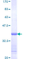CAPN1 / Calpain 1 Protein - 12.5% SDS-PAGE Stained with Coomassie Blue.