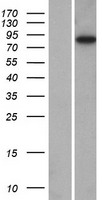 CAPN11 / Calpain 11 Protein - Western validation with an anti-DDK antibody * L: Control HEK293 lysate R: Over-expression lysate