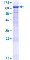CAPN11 / Calpain 11 Protein - 12.5% SDS-PAGE of human CAPN11 stained with Coomassie Blue
