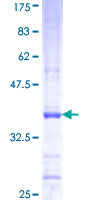CAPN11 / Calpain 11 Protein - 12.5% SDS-PAGE Stained with Coomassie Blue.