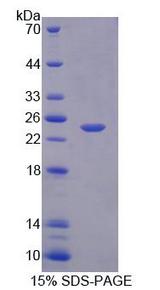 CAPN11 / Calpain 11 Protein - Recombinant Calpain 11 (CAPN11) by SDS-PAGE