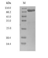 CAPN14 Protein - (Tris-Glycine gel) Discontinuous SDS-PAGE (reduced) with 5% enrichment gel and 15% separation gel.