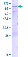 CAPN2 / Calpain 2 / M-Calpain Protein - 12.5% SDS-PAGE of human CAPN2 stained with Coomassie Blue