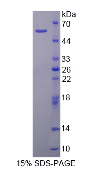 CAPN2 / Calpain 2 / M-Calpain Protein - Recombinant  Calpain 2, Large Subunit By SDS-PAGE