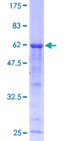 CAPN3 / Calpain 3 Protein - 12.5% SDS-PAGE of human CAPN3 stained with Coomassie Blue