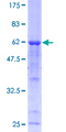 CAPN3 / Calpain 3 Protein - 12.5% SDS-PAGE of human CAPN3 stained with Coomassie Blue