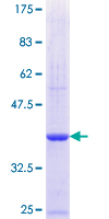 CAPN3 / Calpain 3 Protein - 12.5% SDS-PAGE Stained with Coomassie Blue.