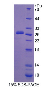 CAPN3 / Calpain 3 Protein - Recombinant Calpain 3 By SDS-PAGE