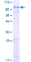 CAPN5 / Calpain 5 Protein - 12.5% SDS-PAGE of human CAPN5 stained with Coomassie Blue