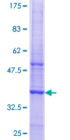 CAPN7 / Calpain 7 Protein - 12.5% SDS-PAGE Stained with Coomassie Blue.