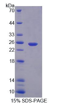 CAPN7 / Calpain 7 Protein - Recombinant Calpain 7 (CAPN7) by SDS-PAGE