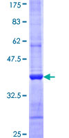 CAPN9 / Calpain 9 Protein - 12.5% SDS-PAGE Stained with Coomassie Blue.