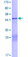 CAPNS1 / CAPN4 Protein - 12.5% SDS-PAGE of human CAPNS1 stained with Coomassie Blue
