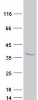 CAPNS2 Protein - Purified recombinant protein CAPNS2 was analyzed by SDS-PAGE gel and Coomassie Blue Staining