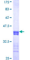 CAPS Protein - 12.5% SDS-PAGE Stained with Coomassie Blue.
