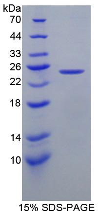 CAPS Protein - Recombinant  Calcyphosine By SDS-PAGE