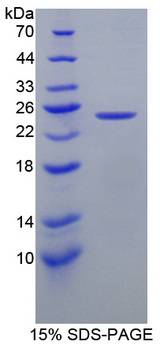 CAPS Protein - Recombinant  Calcyphosine By SDS-PAGE