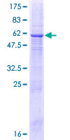 CAPS2 Protein - 12.5% SDS-PAGE of human CAPS2 stained with Coomassie Blue
