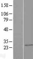 CAPSL Protein - Western validation with an anti-DDK antibody * L: Control HEK293 lysate R: Over-expression lysate