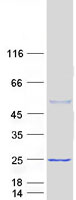 CAPSL Protein - Purified recombinant protein CAPSL was analyzed by SDS-PAGE gel and Coomassie Blue Staining