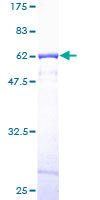 CAPZA1 / CAPZ Alpha 1 Protein - 12.5% SDS-PAGE of human CAPZA1 stained with Coomassie Blue