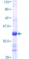 CAPZA1 / CAPZ Alpha 1 Protein - 12.5% SDS-PAGE Stained with Coomassie Blue.