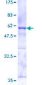 CAPZA2 / CAPZ Alpha 2 Protein - 12.5% SDS-PAGE of human CAPZA2 stained with Coomassie Blue