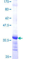 CAPZA2 / CAPZ Alpha 2 Protein - 12.5% SDS-PAGE Stained with Coomassie Blue.