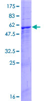 CAPZA3 Protein - 12.5% SDS-PAGE of human CAPZA3 stained with Coomassie Blue