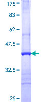 CAPZA3 Protein - 12.5% SDS-PAGE Stained with Coomassie Blue.