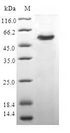 CAPZB / CAPZ Beta Protein - (Tris-Glycine gel) Discontinuous SDS-PAGE (reduced) with 5% enrichment gel and 15% separation gel.