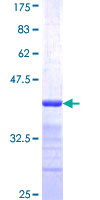 CAPZB / CAPZ Beta Protein - 12.5% SDS-PAGE Stained with Coomassie Blue.
