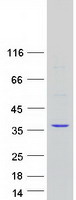 CAPZB / CAPZ Beta Protein - Purified recombinant protein CAPZB was analyzed by SDS-PAGE gel and Coomassie Blue Staining