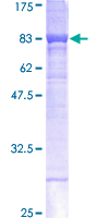 Carboxylesterase 1 / CES1 Protein - 12.5% SDS-PAGE of human CES1 stained with Coomassie Blue